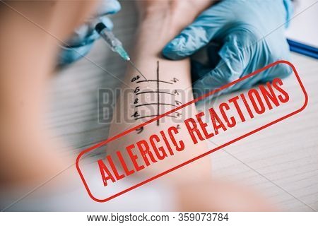 Cropped View Of Allergist Holding Ruler Near Marked Hand Of Woman With Allergic Reactions Illustrati