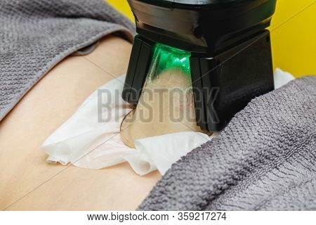Woman Getting Cryolipolysis Fat Treatment Procedure In Beauty Salon