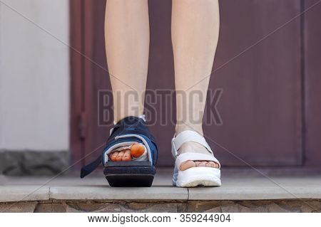 Close-up Woman Legs, One In Bandage And Orthopedic Boot After Trauma Or Surgery.  The Result Of Usin