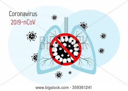 Virus Cells In Lung. Infected Lungs. Coronavirus, Covid-19. 2019-ncov. Lung Disease, Pneumonia, Asth