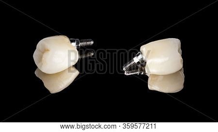 Dental Ceramic Molar Crown On The Implant. View From Different Sides, Isolated On A Black Background
