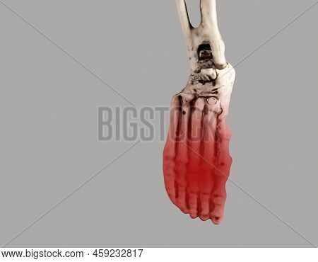 Human Skeleton Foot With Red Point At Forefoot. Injury, Excessive Physical Activity, Ill-fitting Sho