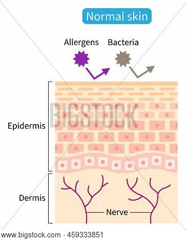 Normal Skin Barrier Helps Retain Moisture And Protect From External Stimuli. Healthy Skin Care Conce