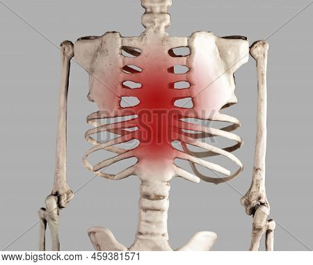 Skeleton With Red Point At Breastbone. Chest And Ribs Pain. Costochondritis. Health Problems, Medica