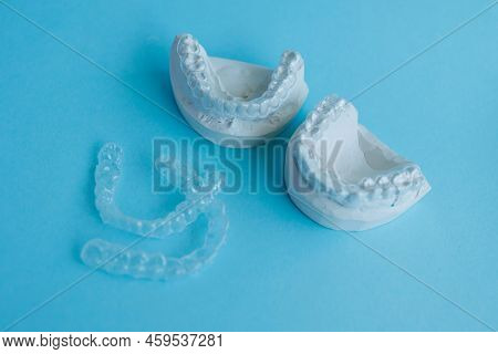 Gypsum Jaws Models With Silicone Invisible Aligners On A Blue Background