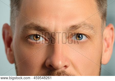 Man With Beautiful Eyes Of Different Colors, Closeup. Heterochromia Iridis