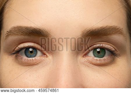 Woman With Beautiful Eyes Of Different Colors, Closeup. Heterochromia Iridis