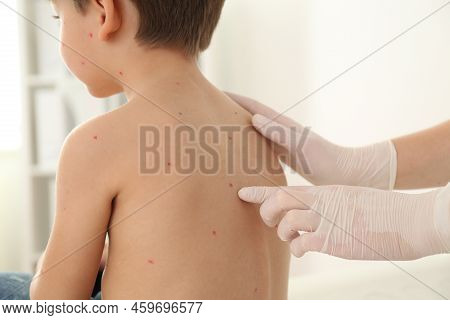 Chickenpox Doctor Doctor Examining Image & Photo (Free Trial) | Bigstock