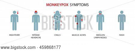 Symptoms Of The Monkey Pox Virus. Monkey Pox Is Spreading. This Causes Skin Infections. Infographic 