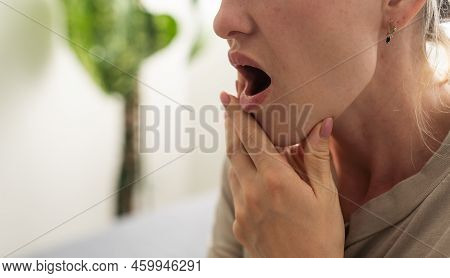 Toothache, Beautiful Woman With Tooth Infection. Young Woman Suffering From Toothache . Close Up Of 