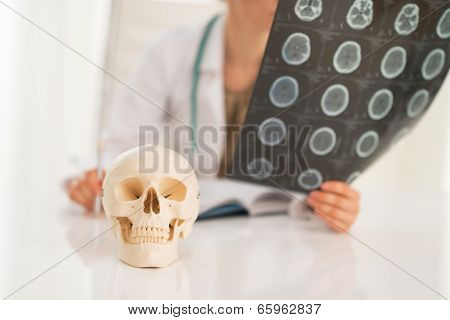 Closeup On Human Skull And Medical Doctor Woman With Fluorograph