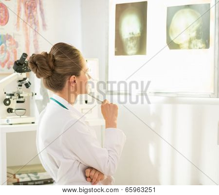 Medical Doctor Woman Looking On Fluorography On Lightbox