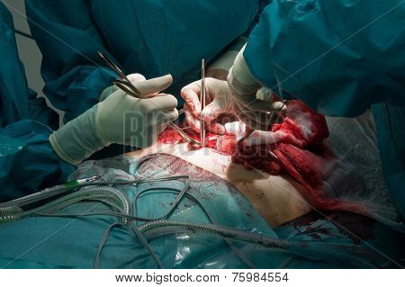 Surgeons Operating In Hospital