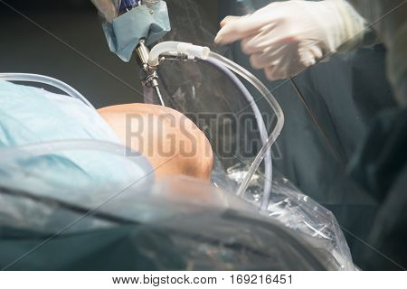 Knee Surgery Hospital Operation