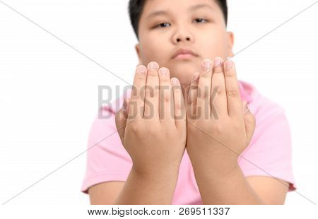 Disgusting Bitten Fingernails On Boy's Hand Isolated