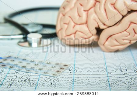 Subdural Electrode Grid On Electroencephalograpy Paper. Human Brain Model And A Black Stethoscope On
