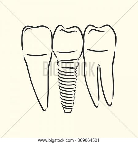 Hand-drawn Black Lines Sketch Molar, Tooth. Doodle Drawing. Object, Element, Icon Component For Illu