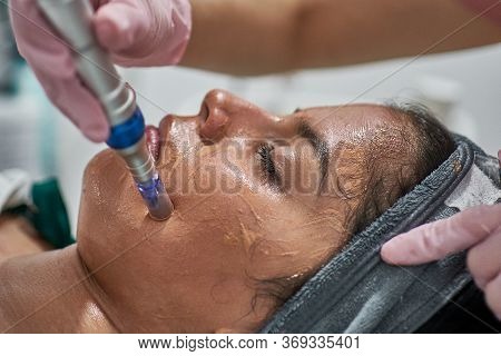 Face Skin Care. Close-up Of Woman Getting Facial Hydro Microdermabrasion Peeling Treatment At Cosmet