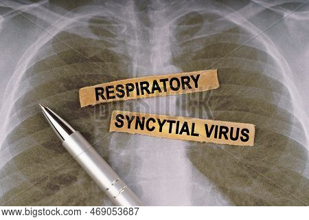 Medical Concept. On A Human Chest X-ray, A Pen And Strips Of Paper Labeled - Respiratory Syncytial V
