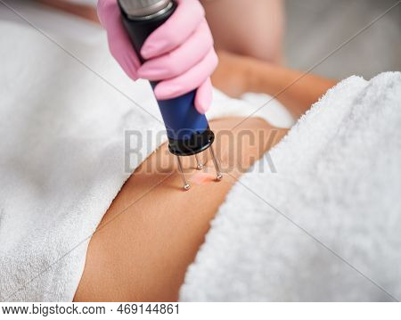 Female Client Receiving Laser Treatment In Cosmetology Clinic. Close Up Doctor Cosmetologist Using E