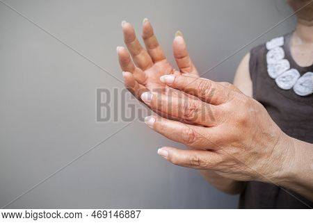 Elderly Woman Suffering From Pain, Numbness Or Weakness In Hands. Causes Of Hurt Include Osteoarthri