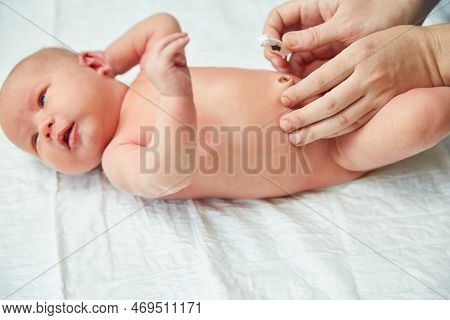 Mom Treats The Umbilical Wound To A Newborn Baby.