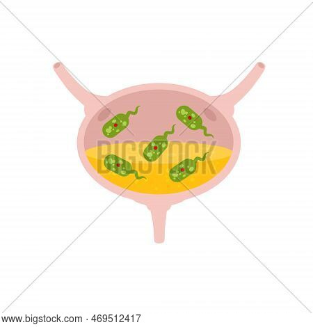 Virus In The Bladder. Infection And Inflammation Of Urine And Internal Organ. Medical Problem And Il