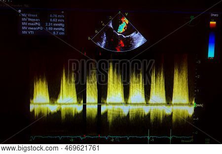 Echocardiogram Colorful Probe Targeting Map And Waveforms