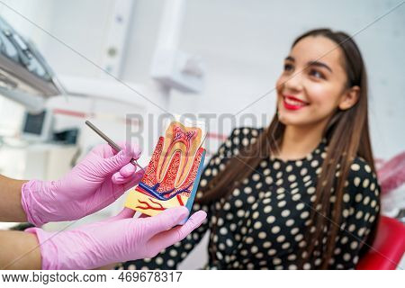 Doctor Shows On A Plastic Tooth Sample Or Model Different Methods Of Teeth Treatment. Patient On Blu