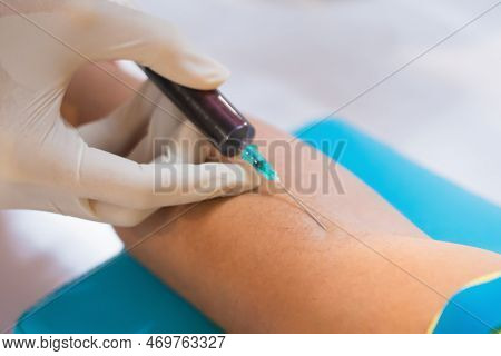 Nurse Collecting A Blood From Patient In Hospital
