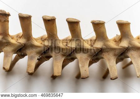 Cervical Vertebra Part Image Photo Free Trial Bigstock Cervical Vertebra Part Image Photo Free Trial Bigstock