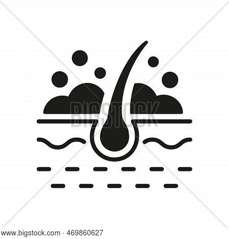 Hair Wash Silhouette Icon. Follicle Washing With Shampoo And Foam Black Glyph Pictogram. Treatment O