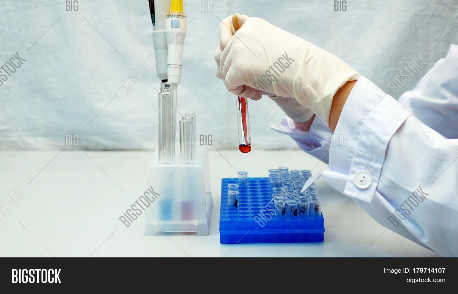 сделать лабораторный анализ. лаборатория крови. лаборатория исследования. сделать лабораторный анализ. тестовые лаборатории картинка.