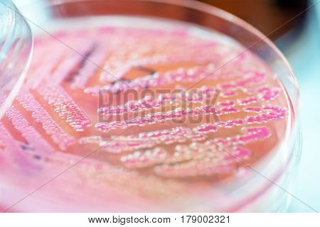Close Up The Media Plate On Hand Medical Technicians Working On Bacterial Culture And Drug Resistanc