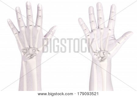 hand bones injury white background hand pain