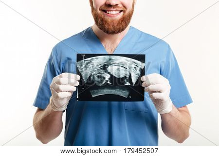 Cropped image of a smiling young male medical doctor or nurse showing radiograph x-ray image isolated on white background