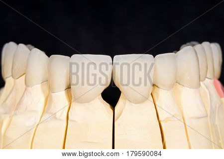 Dental zirconia bridge on isolated black background