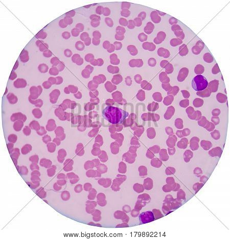 Red Blood Cells And White Blood Cells On White