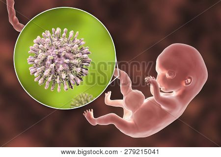 Transplacental Transmission Of Human Immunodeficiency Virus Hiv, Aids Virus To Human Embryo, 3d Illu