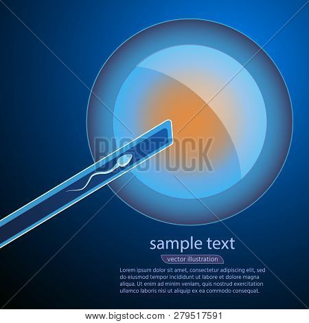 Artificial Insemination. The Fertilized Egg, Washed, Injected Sperm, Uterus, Womb, Syringe. In Vitro