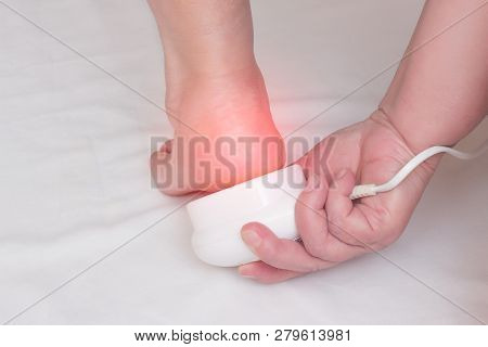 Treatment Of Heel Spurs And Removal Of Inflammation On The Heel With A Magnet Treatment, Physiothera
