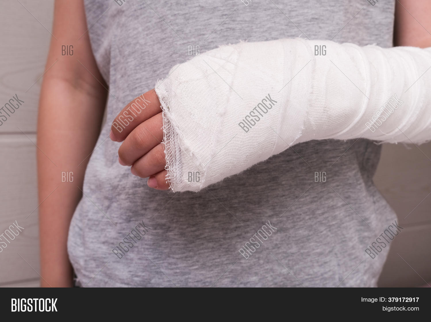 Child Broken Arm Image & Photo (Free Trial) Bigstock