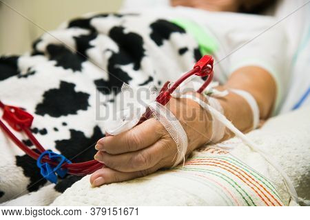Advanced Dialysis Equipment In Hospital
