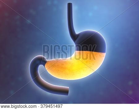 3d Illustration Of Human Stomach With Hydrochloric Acid.