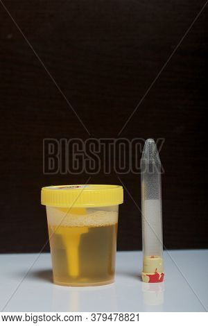 Urine In A Container For Analysis. Disposable Medical Polymer Sterile Container With A Built-in Hold