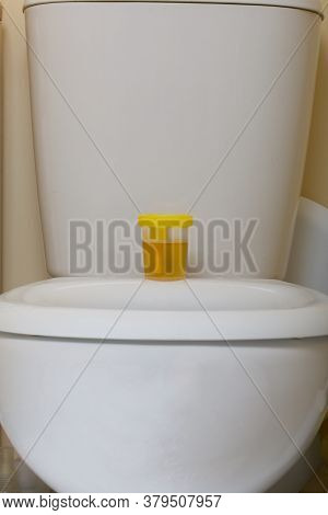 Urine In A Container For Analysis. Stands On The Toilet Seat. Disposable Medical Polymeric Sterile C