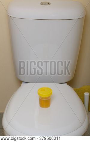 Urine In A Container For Analysis. Stands On The Toilet Lid. Disposable Medical Polymeric Sterile Co