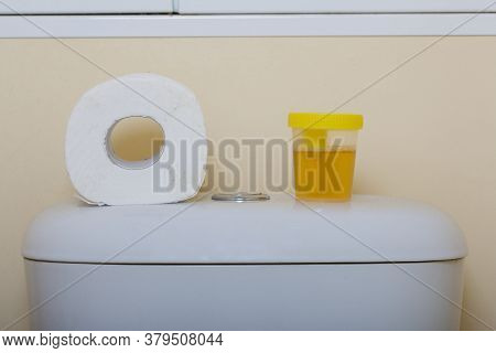 Urine In A Container For Analysis. Stands On The Toilet Cistern. Nearby Is A Roll Of Toilet Paper. D