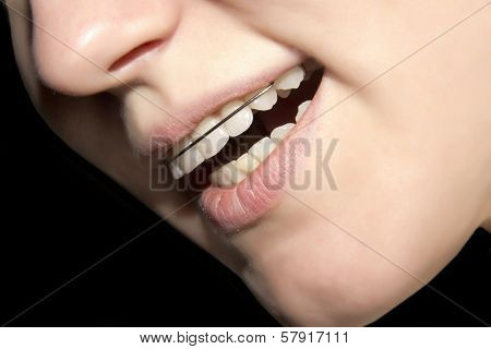 The Young Girl Smiling With Braces On Teeth