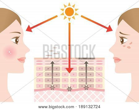 diagram of skin spots. skin care concept